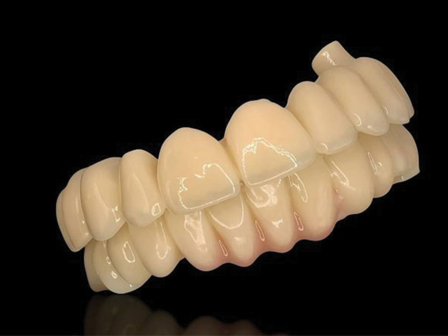 Provisoire en résine