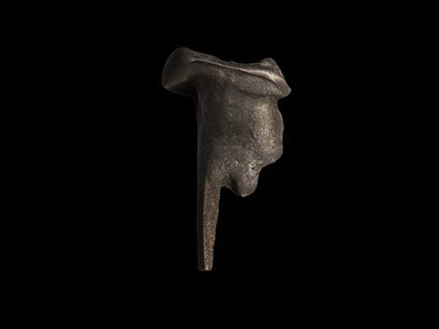 Inlay core métallique