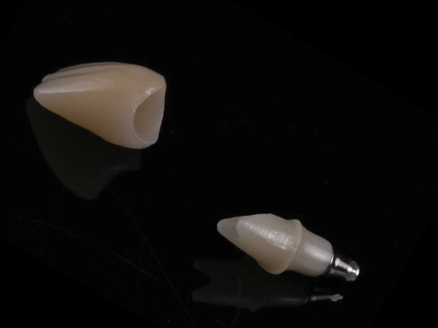 Pilier zircone personnalisé